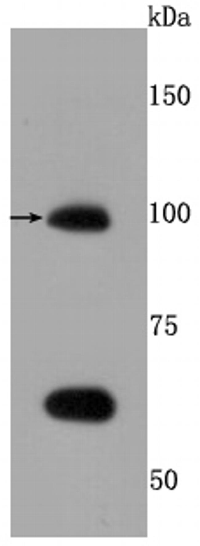 TLR5 Antibody in Western Blot (WB)