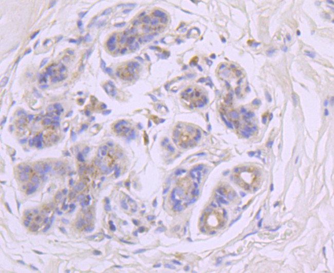 GBA Antibody in Immunohistochemistry (Paraffin) (IHC (P))