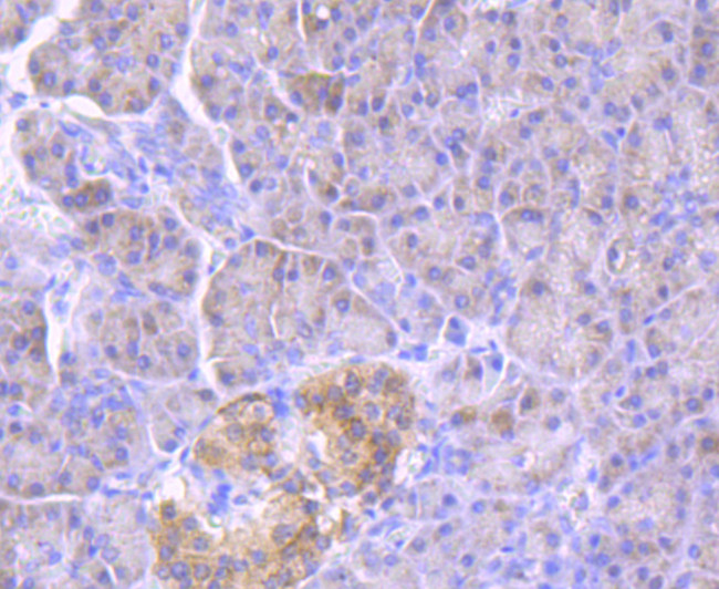 GBA Antibody in Immunohistochemistry (Paraffin) (IHC (P))