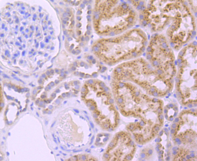 GBA Antibody in Immunohistochemistry (Paraffin) (IHC (P))