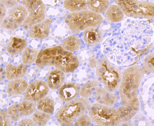 GBA Antibody in Immunohistochemistry (Paraffin) (IHC (P))