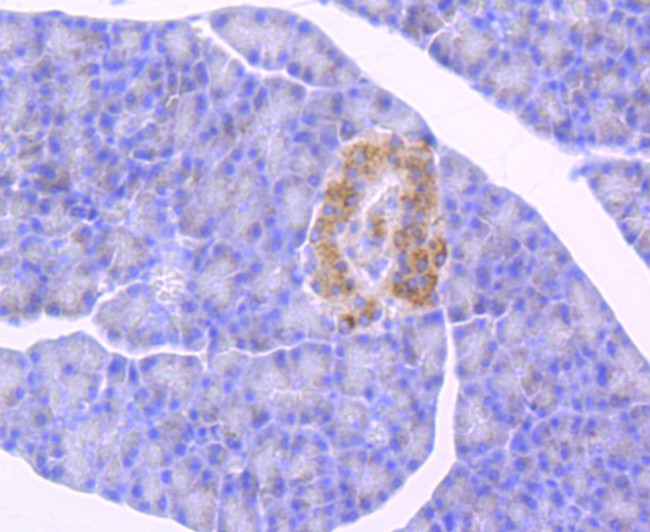 GBA Antibody in Immunohistochemistry (Paraffin) (IHC (P))