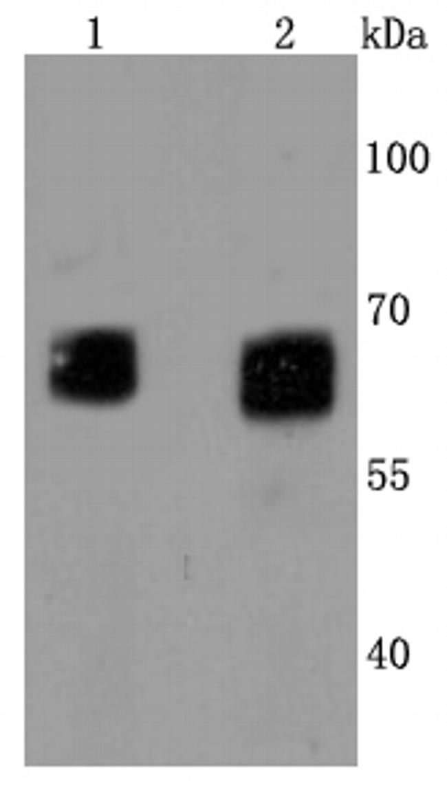 GBA Antibody in Western Blot (WB)