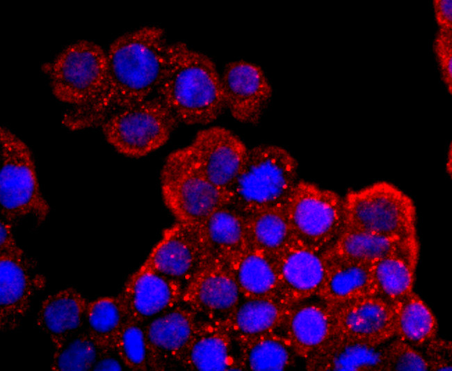 Aquaporin 1 Antibody in Immunocytochemistry (ICC/IF)