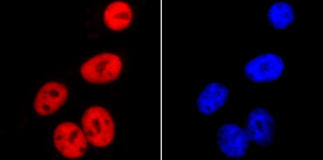 SMC3 Antibody in Immunocytochemistry (ICC/IF)