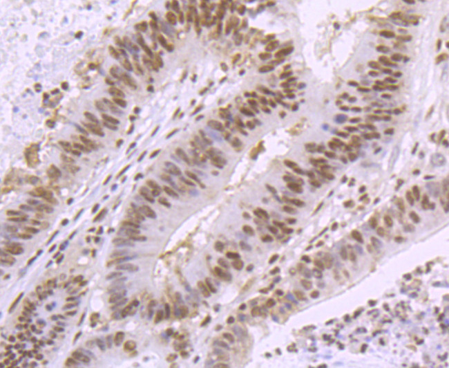 SMC3 Antibody in Immunohistochemistry (Paraffin) (IHC (P))