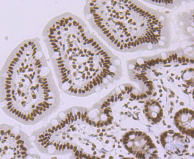 SMC3 Antibody in Immunohistochemistry (Paraffin) (IHC (P))