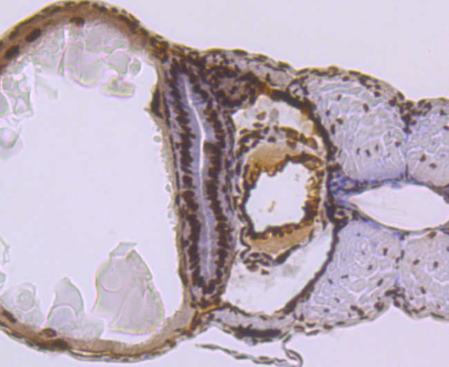 SMC3 Antibody in Immunohistochemistry (Paraffin) (IHC (P))