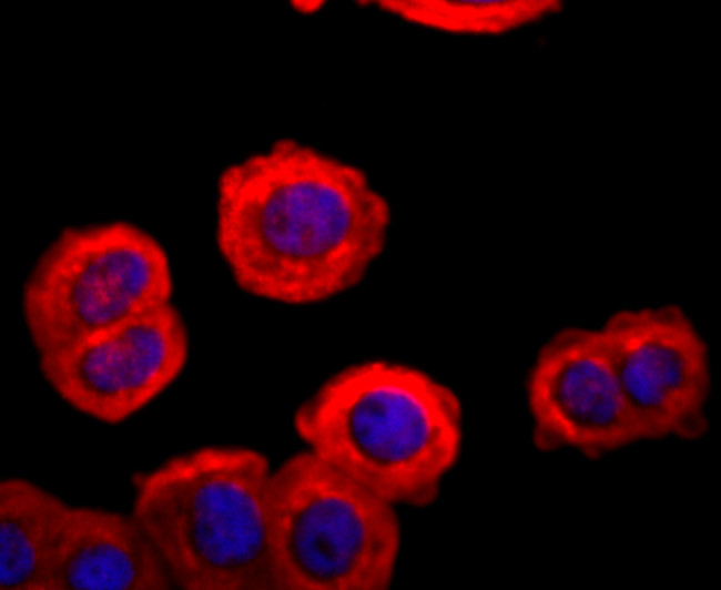 FGFR3 Antibody in Immunocytochemistry (ICC/IF)