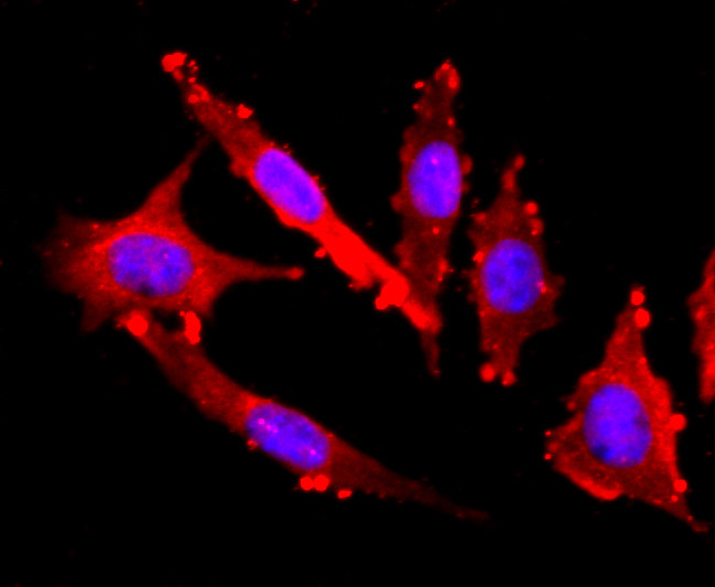 FGFR3 Antibody in Immunocytochemistry (ICC/IF)