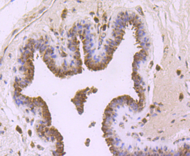 FGFR3 Antibody in Immunohistochemistry (Paraffin) (IHC (P))