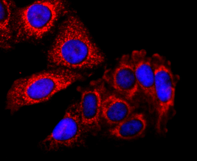 SDHA Antibody in Immunocytochemistry (ICC/IF)