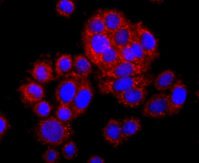 SDHA Antibody in Immunocytochemistry (ICC/IF)