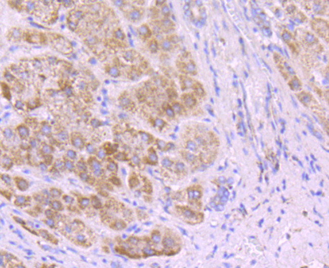 SDHA Antibody in Immunohistochemistry (Paraffin) (IHC (P))