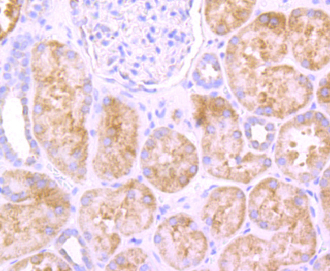 SDHA Antibody in Immunohistochemistry (Paraffin) (IHC (P))