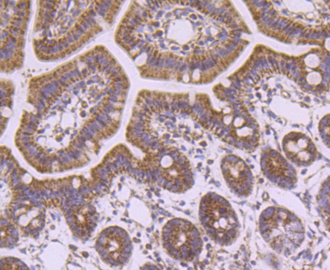 SDHA Antibody in Immunohistochemistry (Paraffin) (IHC (P))