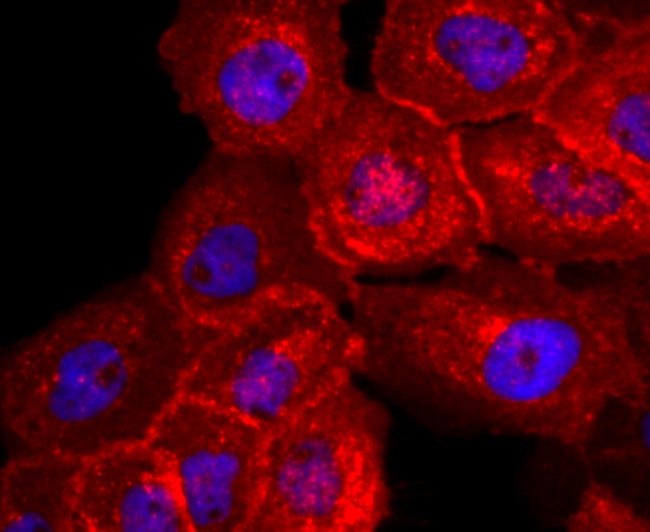 CD138 Antibody in Immunocytochemistry (ICC/IF)