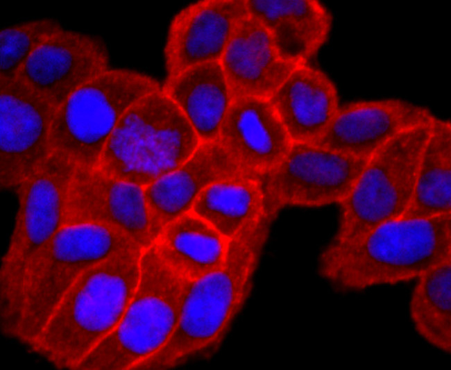 CD138 Antibody in Immunocytochemistry (ICC/IF)