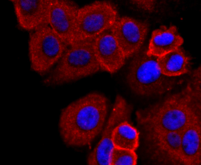 CD138 Antibody in Immunocytochemistry (ICC/IF)