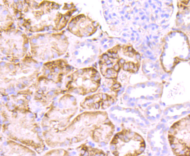 CD138 Antibody in Immunohistochemistry (Paraffin) (IHC (P))