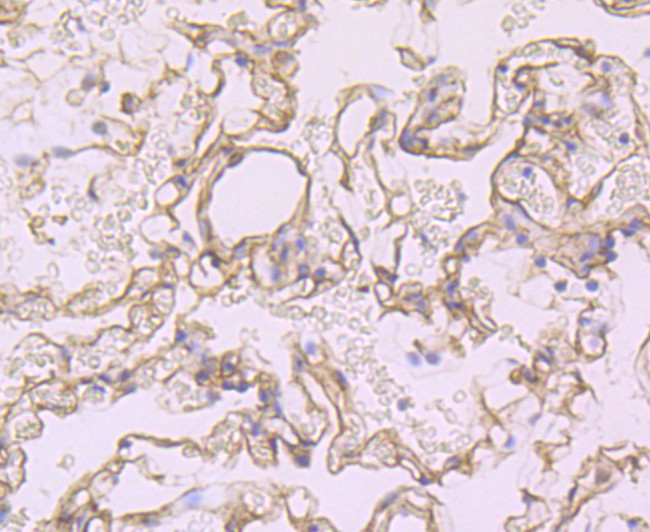 CD138 Antibody in Immunohistochemistry (Paraffin) (IHC (P))