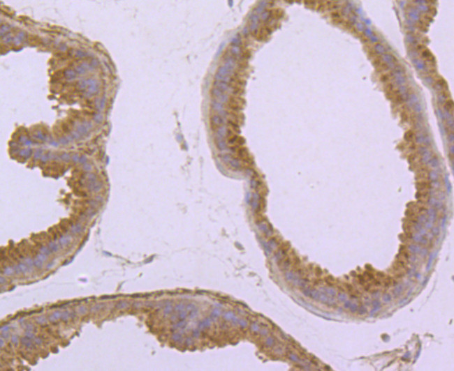 CD138 Antibody in Immunohistochemistry (Paraffin) (IHC (P))