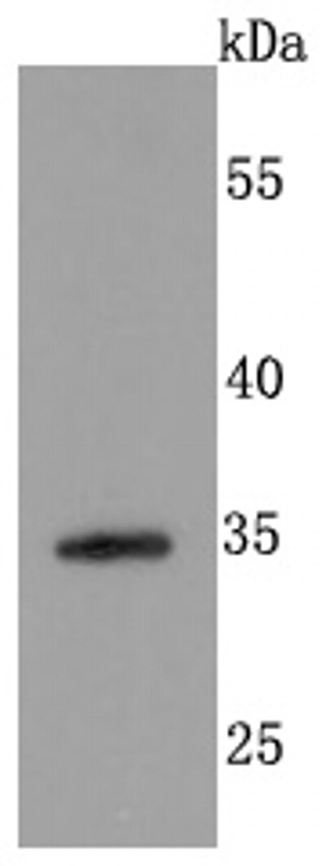 CD138 Antibody in Western Blot (WB)