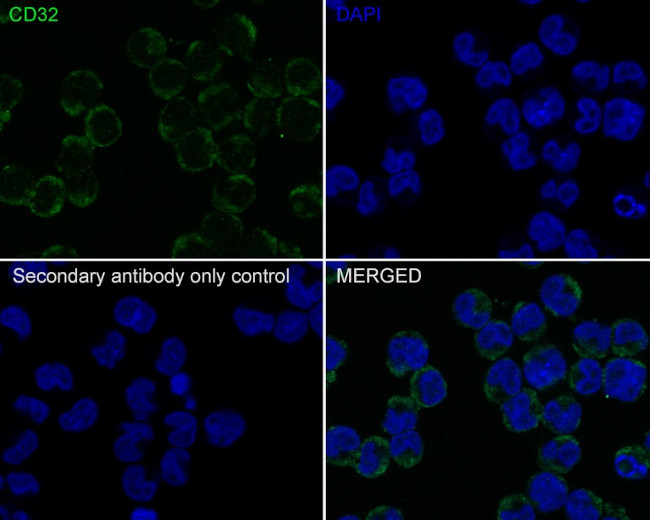 CD32 Antibody in Immunocytochemistry (ICC/IF)