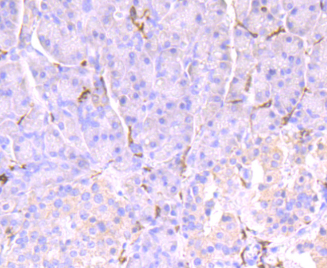 CD32 Antibody in Immunohistochemistry (Paraffin) (IHC (P))