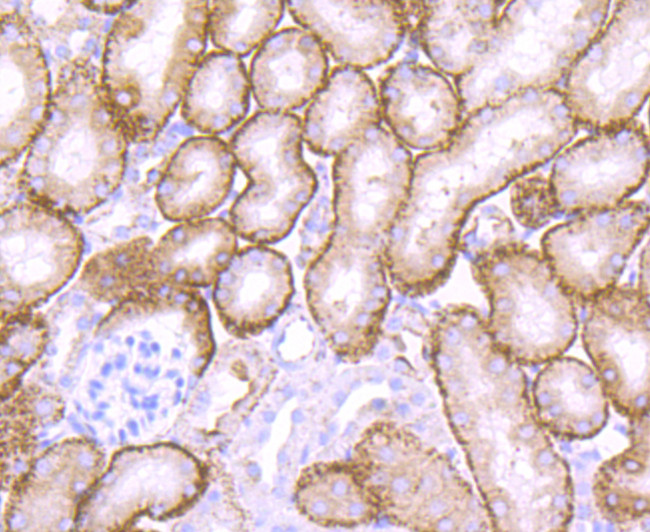 Cathepsin H/K/L/V Antibody in Immunohistochemistry (Paraffin) (IHC (P))