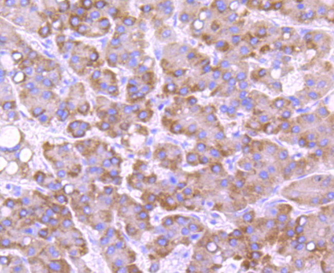 CYP2E1 Antibody in Immunohistochemistry (Paraffin) (IHC (P))