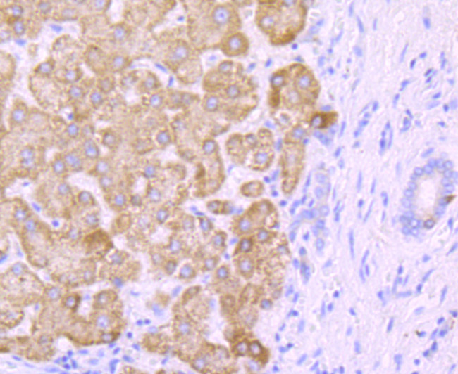 CYP2E1 Antibody in Immunohistochemistry (Paraffin) (IHC (P))