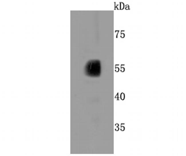 CYP2E1 Antibody in Western Blot (WB)