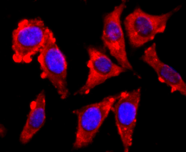 VAMP2 Antibody in Immunocytochemistry (ICC/IF)