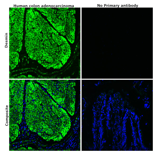 CD104 (Integrin beta 4) Antibody in Immunohistochemistry (Paraffin) (IHC (P))