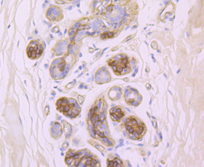 CD104 (Integrin beta 4) Antibody in Immunohistochemistry (Paraffin) (IHC (P))