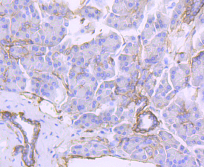 CD104 (Integrin beta 4) Antibody in Immunohistochemistry (Paraffin) (IHC (P))