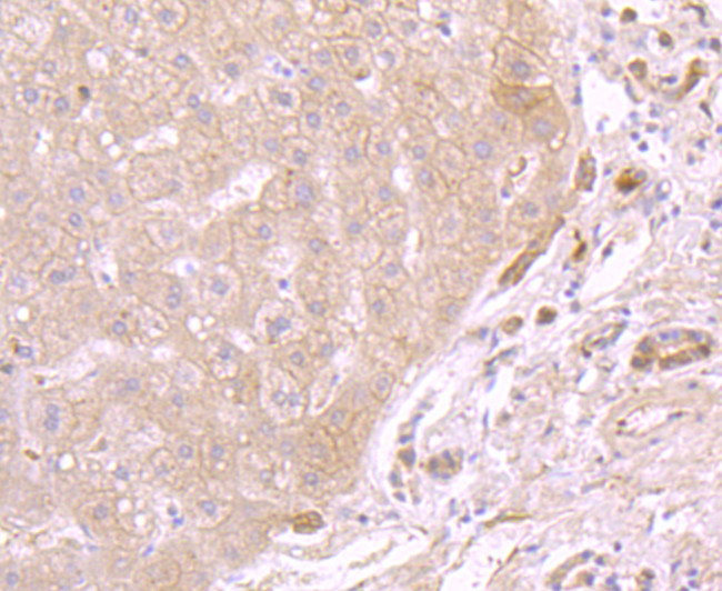 ATP5A1 Antibody in Immunohistochemistry (Paraffin) (IHC (P))