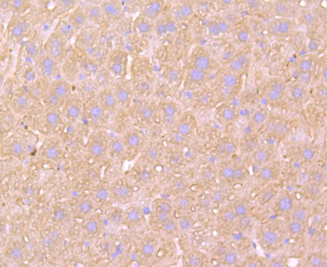 ATP5A1 Antibody in Immunohistochemistry (Paraffin) (IHC (P))