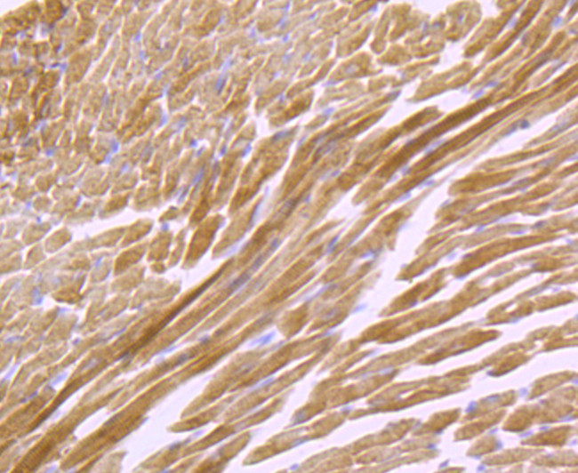 ATP5A1 Antibody in Immunohistochemistry (Paraffin) (IHC (P))