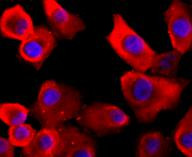 VCP Antibody in Immunocytochemistry (ICC/IF)