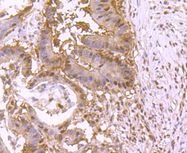 VCP Antibody in Immunohistochemistry (Paraffin) (IHC (P))