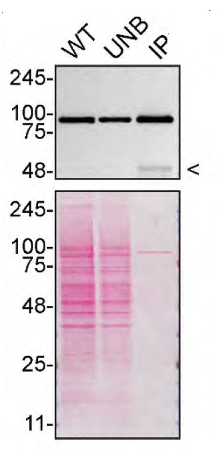 VCP Antibody in Immunoprecipitation (IP)