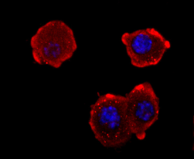 NEFM Antibody in Immunocytochemistry (ICC/IF)