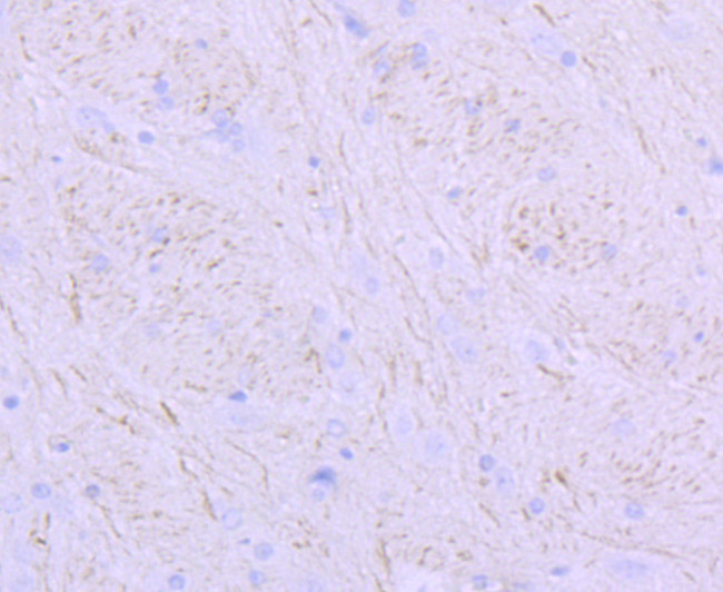 NEFM Antibody in Immunohistochemistry (Paraffin) (IHC (P))