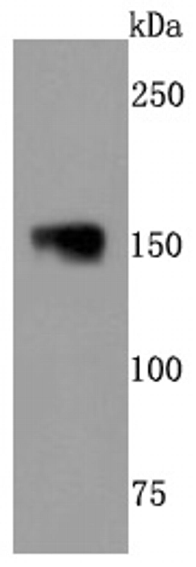 NEFM Antibody in Western Blot (WB)