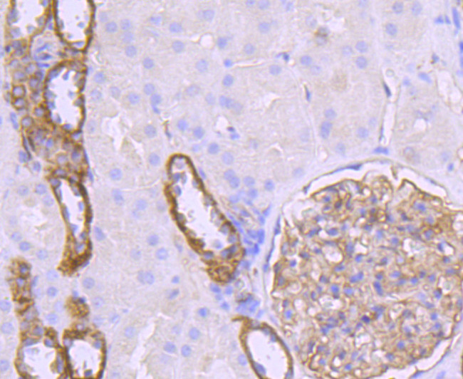 Claudin 5 Antibody in Immunohistochemistry (Paraffin) (IHC (P))