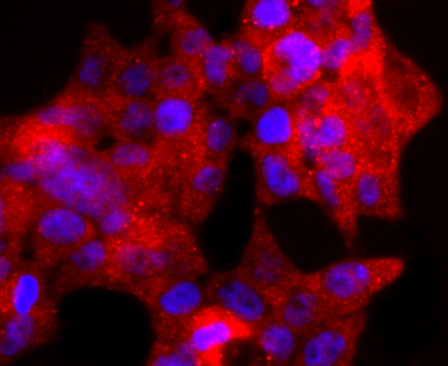 TIA-1 Antibody in Immunocytochemistry (ICC/IF)