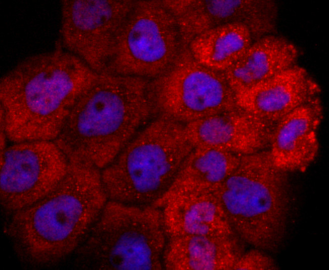 TIA-1 Antibody in Immunocytochemistry (ICC/IF)