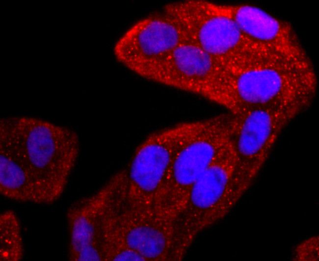 TIA-1 Antibody in Immunocytochemistry (ICC/IF)